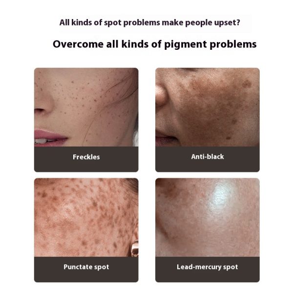 The hospital's one-touch spot clearing decomposes melanin, removes chloasma, freckles, dermal spots, and sunburns and removes freckles with bare hands, whitening （Mild peeling and spot removal）wholesale - Image 3