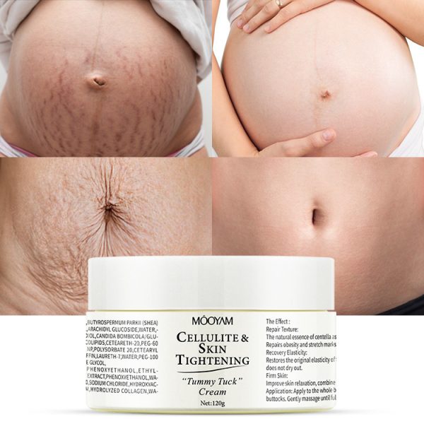 Stretch Mark Cream Obesity Body Mark Repair Cream Firming Nourishing Lightening Postpartum Pregnancy Mark Repair Cream wholesale