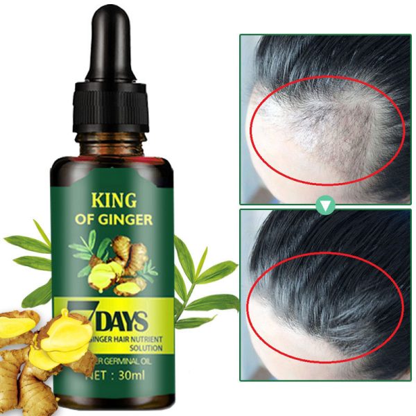 Ginger hair growth essence hair growth liquid plant hair care hair essential oil dense hair essence hair wholesale