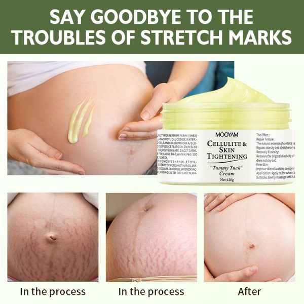 Stretch Mark Cream Obesity Body Mark Repair Cream Firming Nourishing Lightening Postpartum Pregnancy Mark Repair Cream wholesale - Image 4