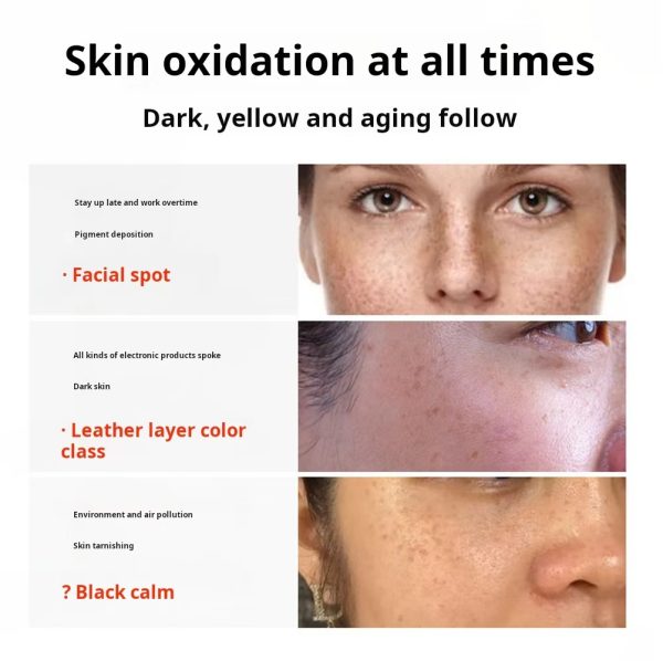 Non-invasive spot dissolving solution, non-peeling, non-scabbing, no embarrassing period, freckle removal solution to remove chloasma, age spots, freckles, melanin decomposition and lightening essence - Image 5