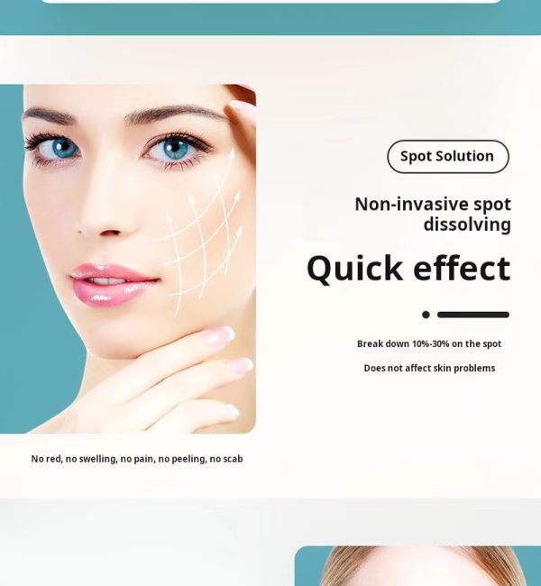 Non-invasive spot dissolving solution, non-peeling, non-scabbing, no embarrassing period, freckle removal solution to remove chloasma, age spots, freckles, melanin decomposition and lightening essence - Image 8