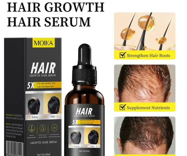 MOIKA Hair Growth Essential Oil Wholesale Scalp Care Essence Essential Oil